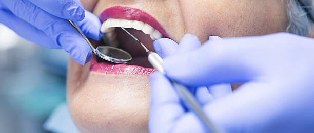 Tooth Infection Emergency Dentist in IA